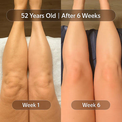 Anti Cellulite Massage Oil