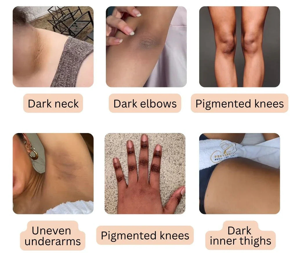 Dark Spot Eraser Spray