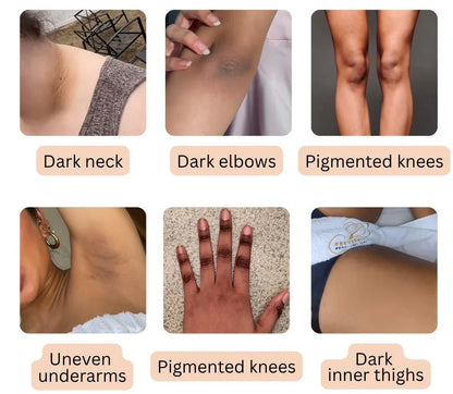 Dark Spot Eraser Spray